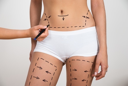 plastic-surgery